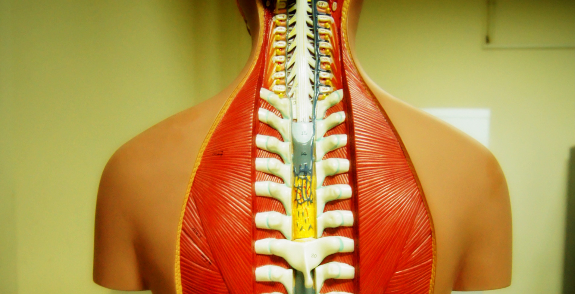 Computer model suggests how surgery may affect stress on spine